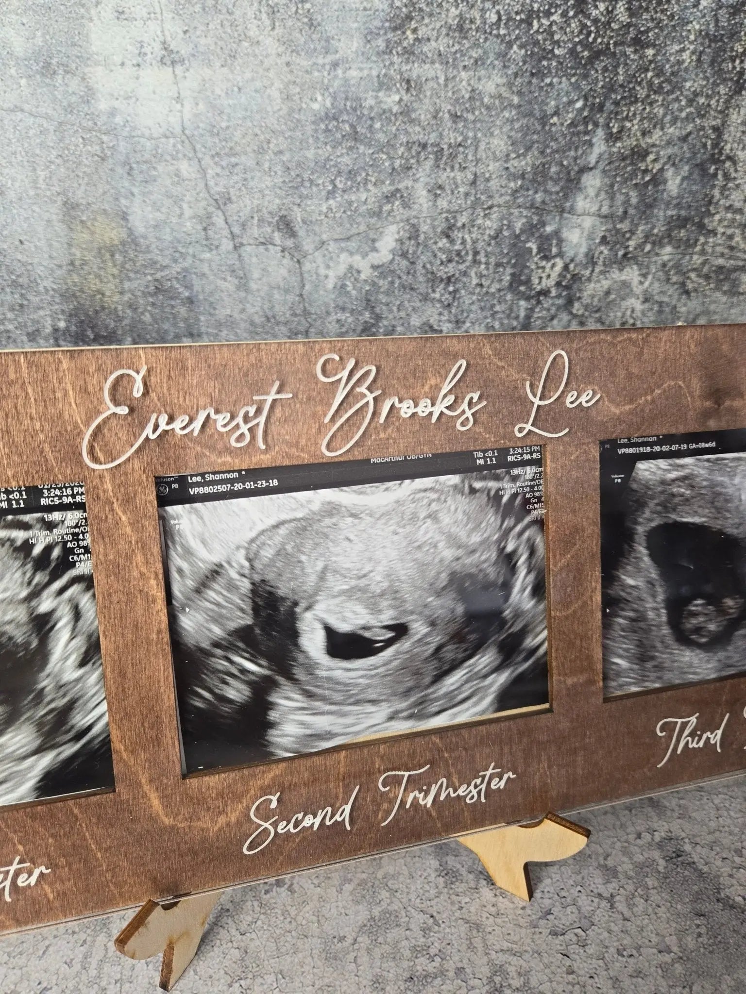 Ultrasound Picture Frame 1st-3rd Trimester by EverLee Creations, Southern home decor detail photo 8