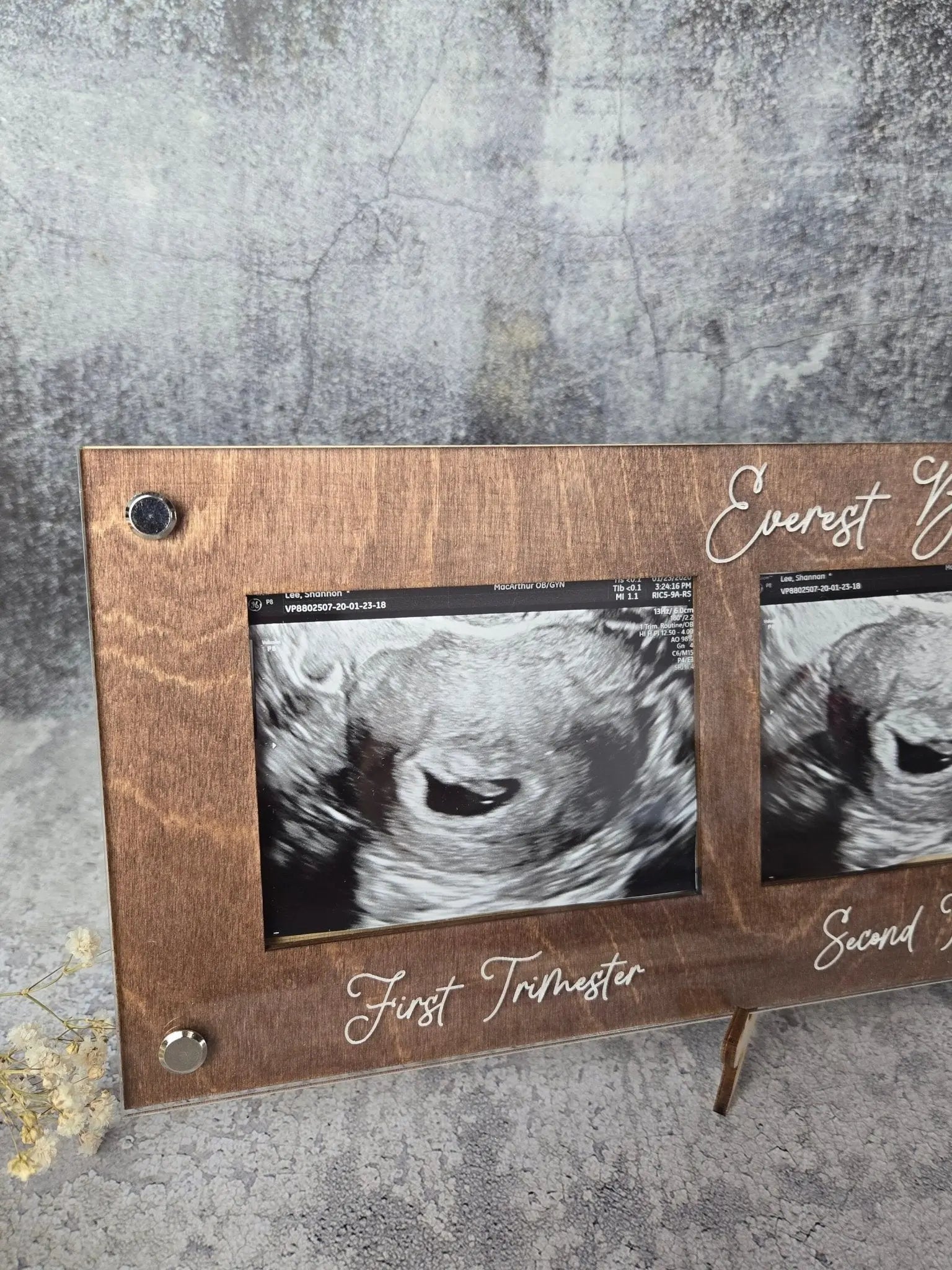 Ultrasound Picture Frame 1st-3rd Trimester by EverLee Creations, Southern home decor detail photo 9