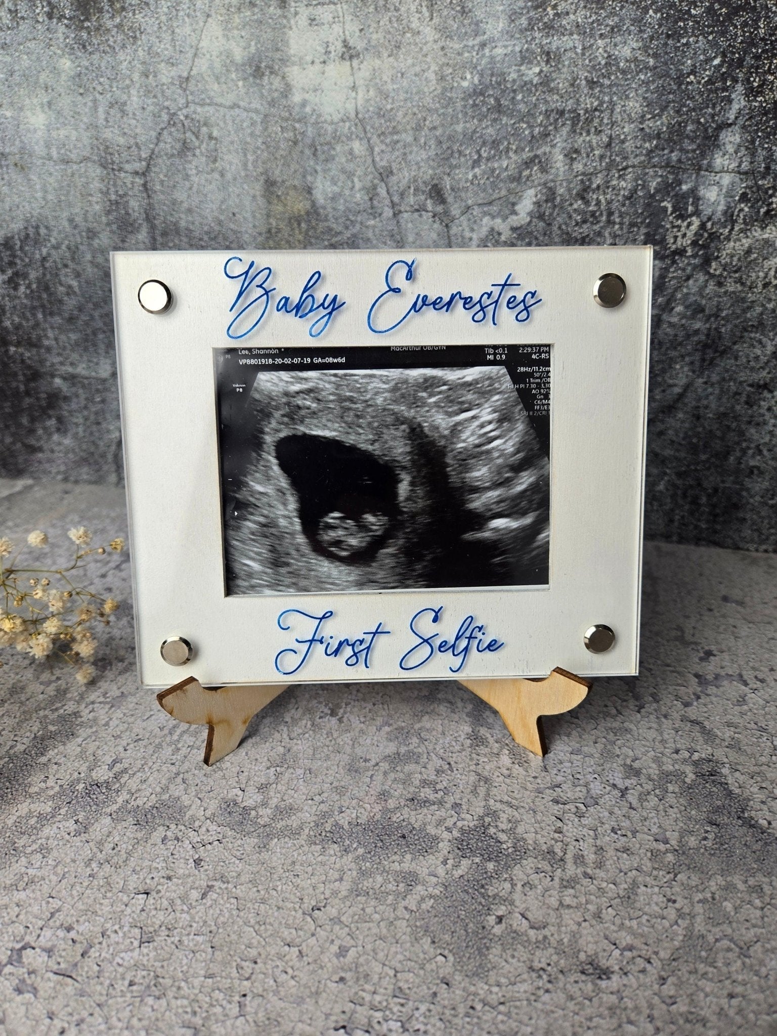 Ultrasound Picture Frame detail view by EverLee Creations
