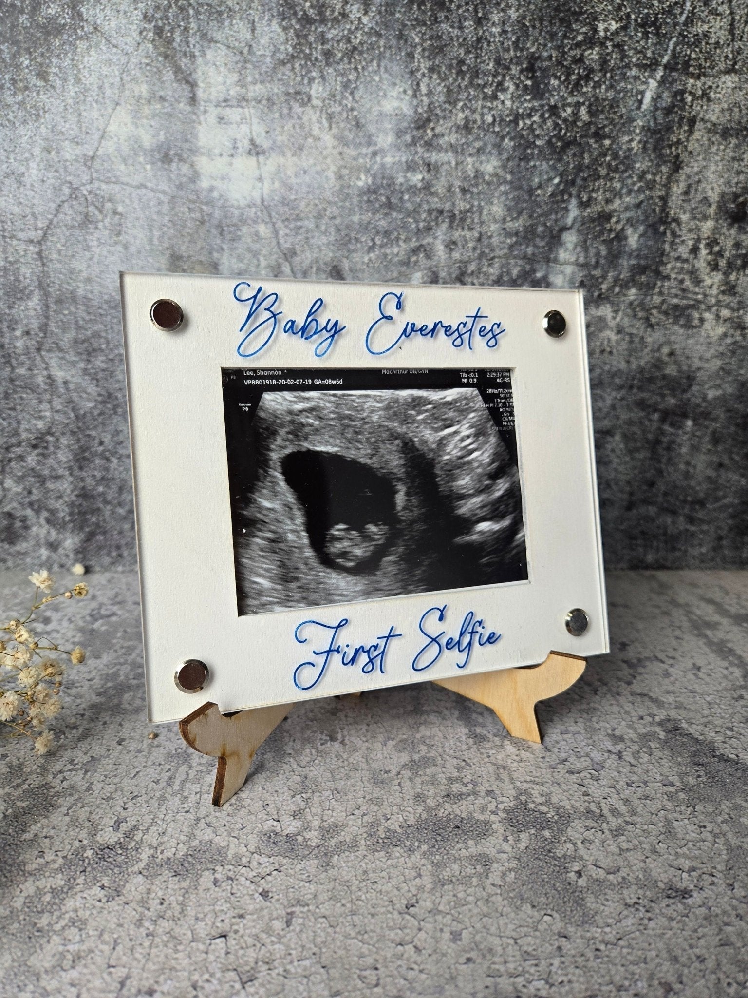 Ultrasound Picture Frame detail view by EverLee Creations